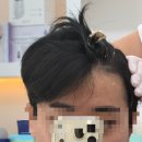 힐 아로마 | 대구두피관리 "힐헤드스파"에서 받은 아로마 두피 클리닉 솔직한 후기