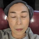 부산잡티관리 연산동 H뷰티엠 비타민관리로 톤업