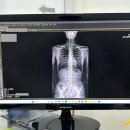 유어템컴퍼니 | 후두하근 마사지기 아쉬운점까지 솔직후기
