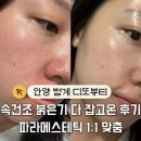 빛과영혼을찾아서 | 안양 범계 '디또뷰티' 속건조 잡고 물광으로 거듭난 후기