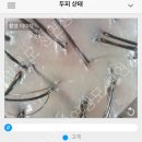 한올두피탈모
