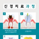 상아치과재료 이미지