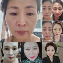 인셀덤237대리점 이미지