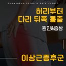 김천참좋은마취통증의학과의원 | 김천마취통증의학과, 엉덩이 깊은 곳에서 느껴지는 통증, '이상근증후군'?