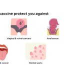 HPV 뜻 바이러스 원인 암 HPV 백신 예방접종 치료제 이미지