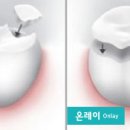 즐거운치과기공소 이미지