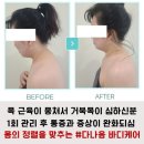 디케어 이미지