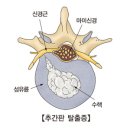 허리디스크, 척추관 관절, 요추추간판 탈출증, 관절염... 학문,지식, 의학... 그 무지와 어리석음의 한계/ 만병의 원인과 완치 원리- 진실된 지식이란... 이미지