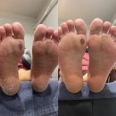 [인천 부평] 문제성 피부 전문 몽몽드 피부관리샵 패디 플래닝, 슈텀프 후기 + 내돈내산