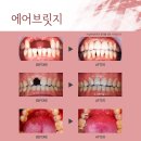 링크브릿지 이미지