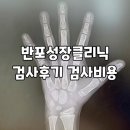 (주)지지엔터테인먼트 | 상위0.01%태어난아이 키성장판검사 후기