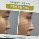 뉴원성형외과의원 이미지