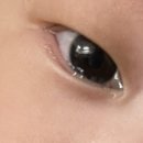 원주김안과의원 | 선천 눈물길 막힘(원주 우리안과의원, 서울 영등포 김안과병원)