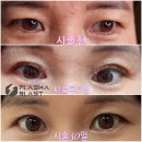 [공지] 용인 플라즈마블라스트 시술&amp;수강, 에스플로리아에서 피부고민 해결하고 맞춤형화장품 제조와 나...