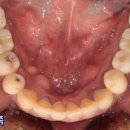 이도치과기공소 이미지