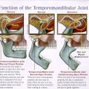턱관절 장애(temporomandibular joint Disorder,TMJ) 2 이미지