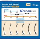 눈에존안경 네이버블로그