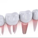 에이스치과의원 이미지