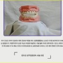 치아살리기 드림365치과의원 이미지