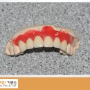 다이안치과기공소 이미지