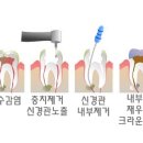손강하치과의원 네이버블로그