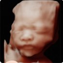 삼미상사(주) 남부주유소 | 임신 25-26주 | 임당검사 통과. 2차 입체초음파. 스쳐지나간 역류성 식도염. 태양의 서커스 쿠자...