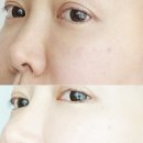 홈에서 즐기는 셀프 피부관리 | 셀프피부관리 위한 아지크 스킨 리셋 프로그램 실버박스, 홈에스테틱 후 광채피부 후기