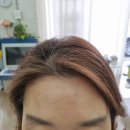 김해대로 2505번길 | 부산 앞머리 모류 교정하러 왔다가 정수리까지 교정한 이유