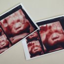 썸의원 | 임신 29주차 - 덕천 미래로병원 3차 정밀초음파, 백일해접종 후기 / 1과 박승섭원장님 퇴사소식