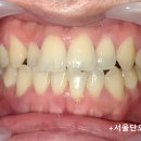 최강치과기공소 이미지