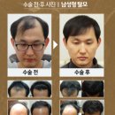 닥터안헤어플란트의원 이미지