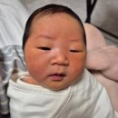 분당삼평-D-9 | <분당제생병원> 생리적 황달 7박 8일 입원 후기