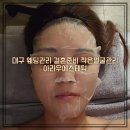 대구 웨딩관리 결혼준비 작은얼굴관리 l 아라우에스테틱