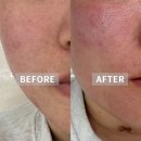 쏘벨르 Sobelle beauty | [아임쏘뷰티] 대구피부관리 꼼꼼하게 잘하는 곳 | 벨르 물광관리 후기