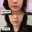 마스타테크니션 | 부산경락샵 찾고있다면? 웨딩관리 가인미가 부산 서면에스테틱 정착했어요