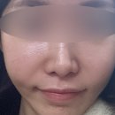 압구정리더스피부과의원 | 압구정 피부과, ”오퍼스의원“ 아기레이저 디오레듀얼 후기