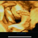 김포에이치(H)병원 | 임신 25주차 • 도봉 에이치큐브 병원 • 입체초음파 • 임신성당뇨검사 후기,결과