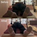 라인업 체형교정 이미지