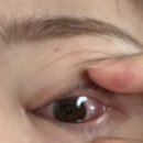 진천밝은안과의원 이미지