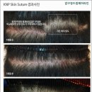 드림헤어라인의원 네이버블로그