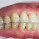 바이오크리닝 이미지