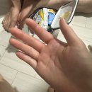 에스엔케이 | [교상 후기] 고양이 물림 사고