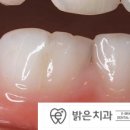 이(e)-밝은치과의원 이미지