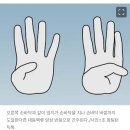 엄지손가락 쭉 뻗었을 때 ‘이 모양’이면… 몸속에 대동맥류 있다는 신호 이미지