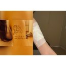 읻다의원 | [읻다의원-문신제거 클리닉] 서울/청담 타투 레이저 제거 1회차 따끈따끈✨ 내돈내산 후기