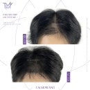 체인지유 이미지