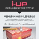 아이업 이미지
