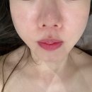 서산피부관리 더아름다워져 :: 민감피부 한번에 진정시키기