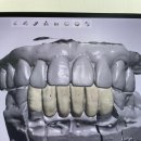 나라치과기공소 이미지