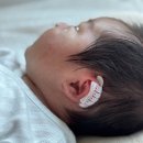 더타임 의료기기 | 신생아 귀 교정 후기, 접힌 귀 골든타임부터 귀 교정기 사용부 생후 60일 변화